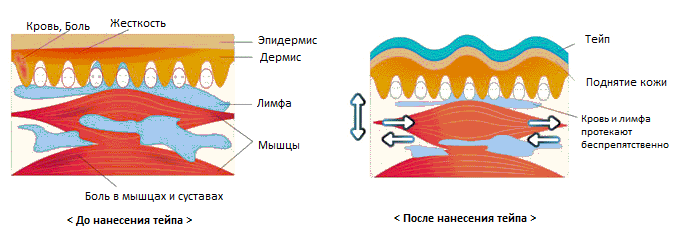 Как работают тейпы картинки